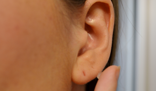En combien de temps se rebouche un piercing au nez ?